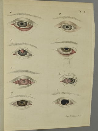 DIE KRANKENHEITEN DES MENSCHLICHEN AUGES, EIN HANDBUCH FUR ANGEHENDE AERZTE.