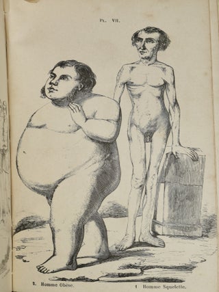 LA VENUS FECONDE ET CALLIPEDIQUE THEORY NOUVELLE DE LA FECONDATION MALE ET FEMELLE ... CALLIPLASTIE-ORTHOPEDIE. ART DE REDRESSER LES DEFORMITIES DU CORPS CHEZ LES ENFANTS.
